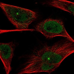 PGLS Antibody, Novus Biologicals 0.1mL; Unlabeled:Antibodies, Polyclonal